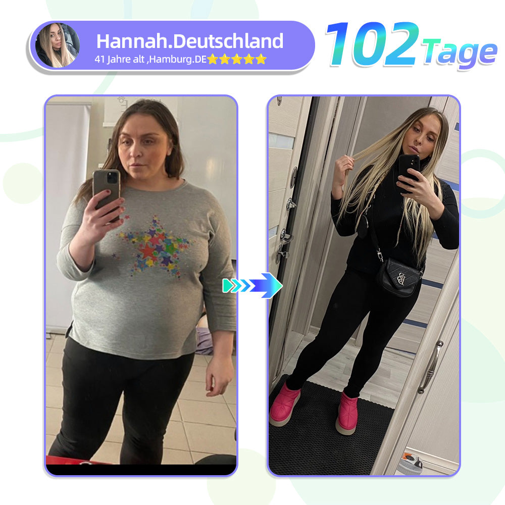 EZSLlNN® 🏆 SMG𝐓-GLP-1 Nano-Mikronadel-Pflaster 2.0 (✅Schmerzfrei, lang anhaltend, gegen Diabetes, Fettleibigkeit und Herz-Kreislauf-Erkrankungen) - 🔥7 Tage, um Ergebnisse zu sehen