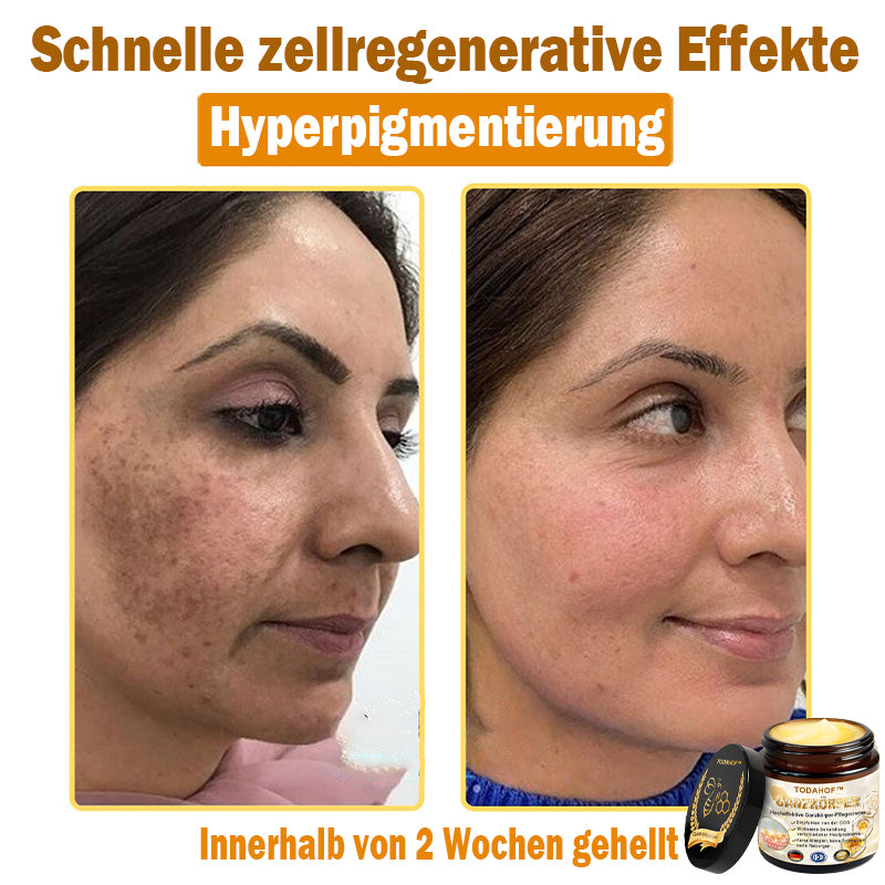 Steroidfrei🥑 TODAHOF® Hocheffektive Ganzkörper Pflegecreme 👩⚕️ (für mehrere Bereiche und Hautprobleme)