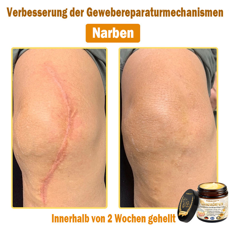 Steroidfrei🥑 TODAHOF® Hocheffektive Ganzkörper Pflegecreme 👩⚕️ (für mehrere Bereiche und Hautprobleme)