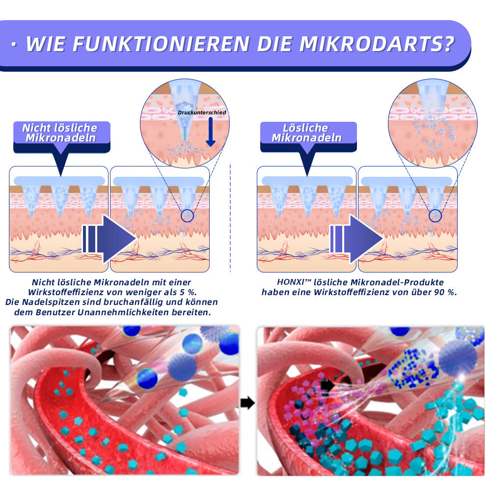 EZSLlNN® 🏆 SMG𝐓-GLP-1 Nano-Mikronadel-Pflaster 2.0 (✅Schmerzfrei, lang anhaltend, gegen Diabetes, Fettleibigkeit und Herz-Kreislauf-Erkrankungen) - 🔥7 Tage, um Ergebnisse zu sehen