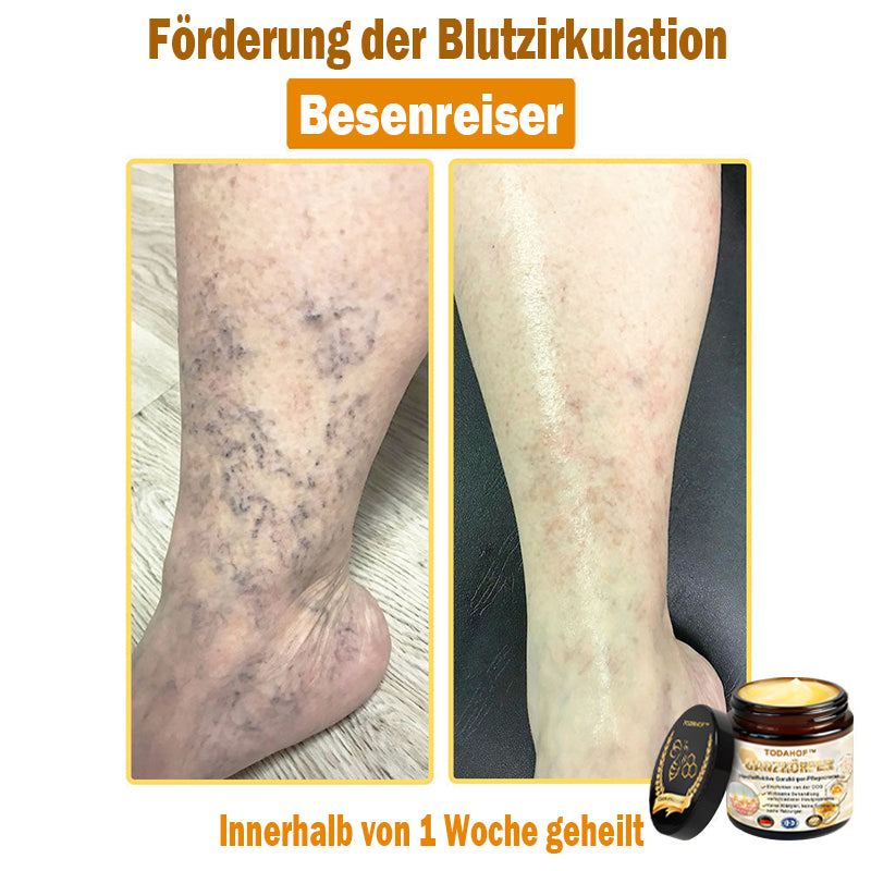 Steroidfrei🥑 TODAHOF® Hocheffektive Ganzkörper Pflegecreme 👩⚕️ (für mehrere Bereiche und Hautprobleme)