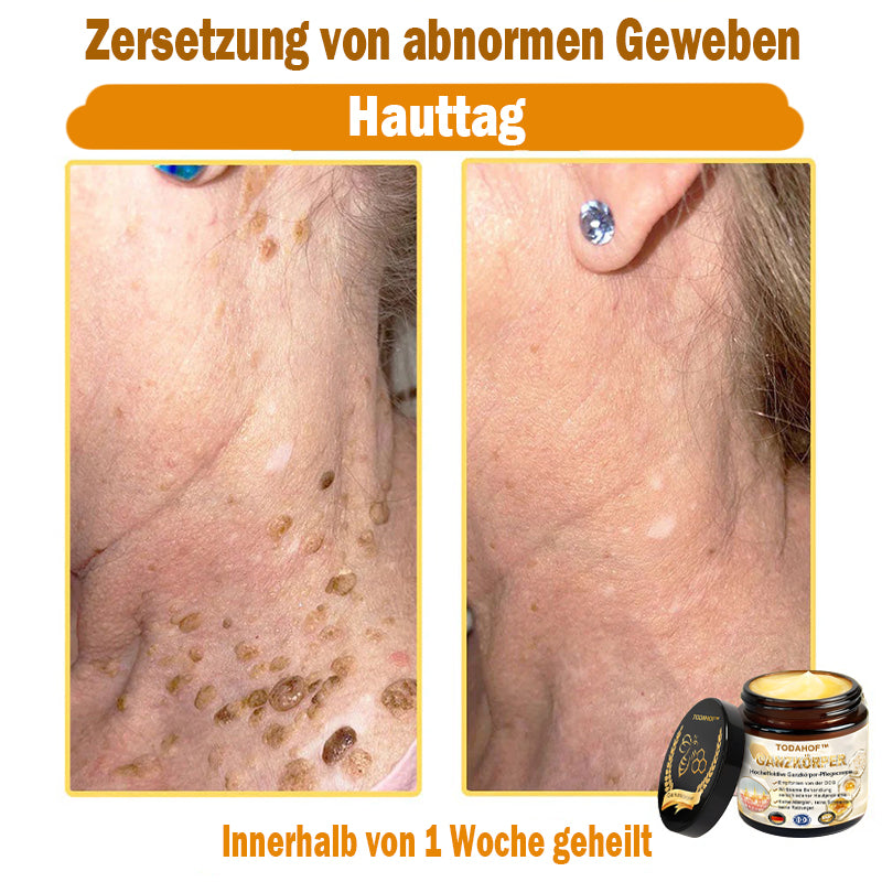 Steroidfrei🥑 TODAHOF® Hocheffektive Ganzkörper Pflegecreme 👩⚕️ (für mehrere Bereiche und Hautprobleme)