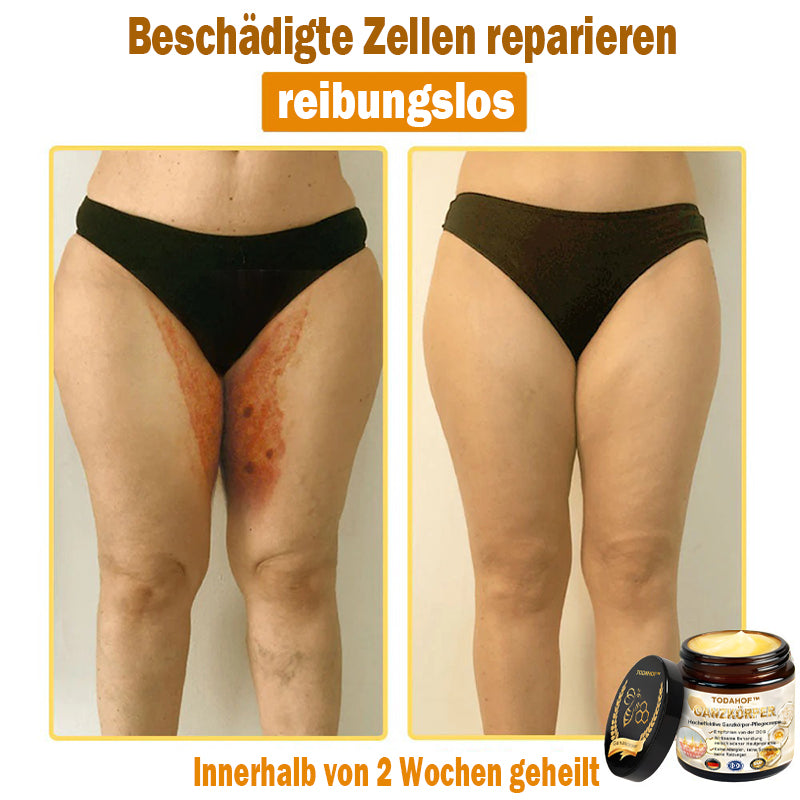 Steroidfrei🥑 TODAHOF® Hocheffektive Ganzkörper Pflegecreme 👩⚕️ (für mehrere Bereiche und Hautprobleme)