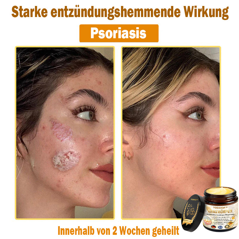 Steroidfrei🥑 TODAHOF® Hocheffektive Ganzkörper Pflegecreme 👩⚕️ (für mehrere Bereiche und Hautprobleme)