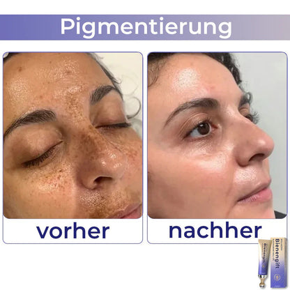 🐝𝑻𝑶𝑫𝑨H𝑶𝑭® 𝗞𝗼𝗹𝗹𝗮𝗴𝗲𝗻+ 𝗕𝗶𝗲𝗻𝗲𝗻𝗴𝗶𝗳𝘁 𝗔𝘂𝗴𝗲𝗻𝗰𝗿𝗲𝗺𝗲 𝗥𝗼𝗹𝗹-𝗼𝗻 👩‍⚕️Vom Dermatologen genehmigt