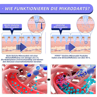 EZSLlNN®  🏆 SMG𝐓-GLP-1 Nano-Mikronadel-Pflaster 2.0 (✅Schmerzfrei, lang anhaltend, gegen Diabetes, Fettleibigkeit und Herz-Kreislauf-Erkrankungen) - 🔥7 Tage, um Ergebnisse zu sehen