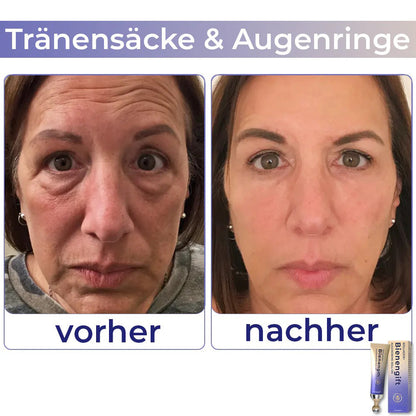 🐝𝑻𝑶𝑫𝑨H𝑶𝑭® 𝗞𝗼𝗹𝗹𝗮𝗴𝗲𝗻+ 𝗕𝗶𝗲𝗻𝗲𝗻𝗴𝗶𝗳𝘁 𝗔𝘂𝗴𝗲𝗻𝗰𝗿𝗲𝗺𝗲 𝗥𝗼𝗹𝗹-𝗼𝗻 👩‍⚕️Vom Dermatologen genehmigt