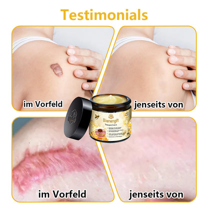 🥑𝑻𝒖𝒓𝒐𝒏𝒖®𝑩𝒊𝒆𝒏𝒆𝒏𝒈𝒊𝒇𝒕 𝑯𝒂𝒖𝒕𝒃𝒆𝒉𝒂𝒏𝒅𝒍𝒖𝒏𝒈𝒔𝒄𝒓𝒆𝒎𝒆（𝑬𝒎𝒑𝒇𝒆𝒉𝒍𝒖𝒏𝒈 𝒅𝒆𝒓 𝑫𝑫𝑮）