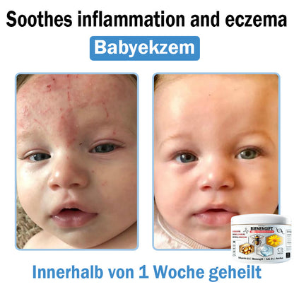 𝐓𝐎𝐃𝐀𝐇𝐎𝐅® 🍯 𝑩𝒊𝒆𝒏𝒆𝒏𝒈𝒊𝒇𝒕 𝑴𝒖𝒍𝒕𝒊𝒔𝒚𝒎𝒑𝒕𝒐𝒎 𝑩𝒆𝒉𝒂𝒏𝒅𝒍𝒖𝒏𝒈𝒔𝒄𝒓𝒆𝒎𝒆 (👨‍⚕𝐃𝐃𝐆 𝐄𝐦𝐩𝐟𝐨𝐡𝐥𝐞𝐧)